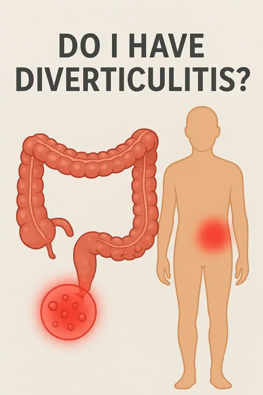 Do I have diverticulitis?
