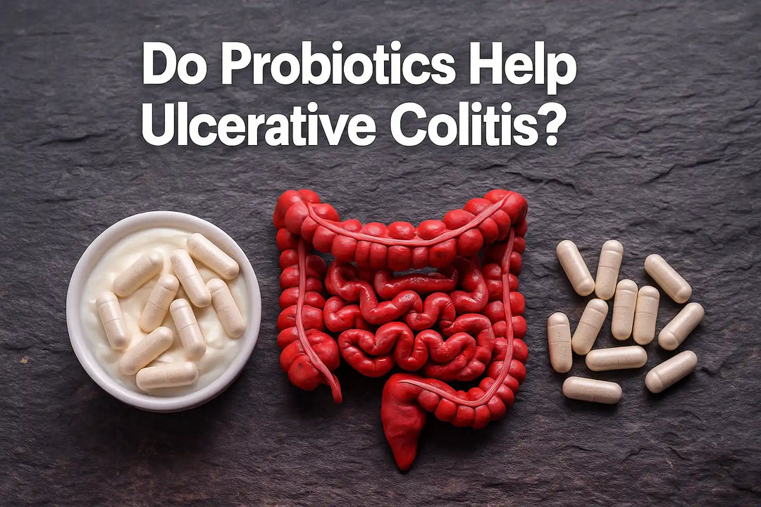 Do Probiotics Help Ulcerative Colitis?