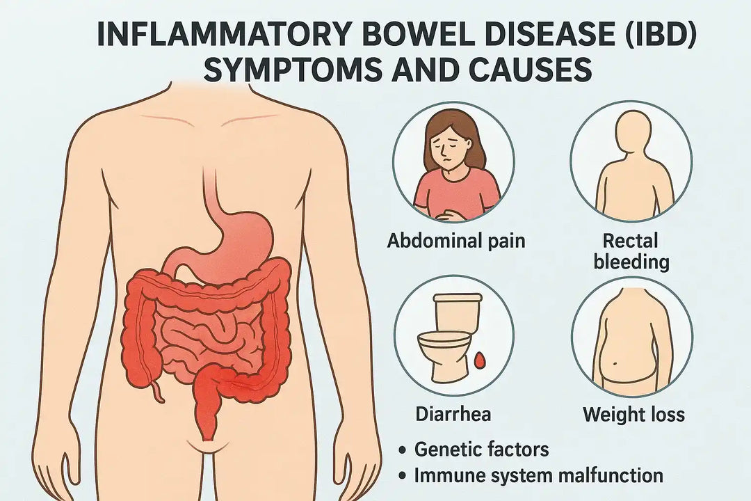 Inflammatory Bowel Disease (IBD) Symptoms and Causes